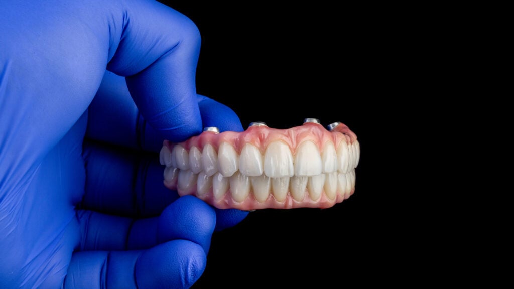fixed implant dentures, dentures Vancouver