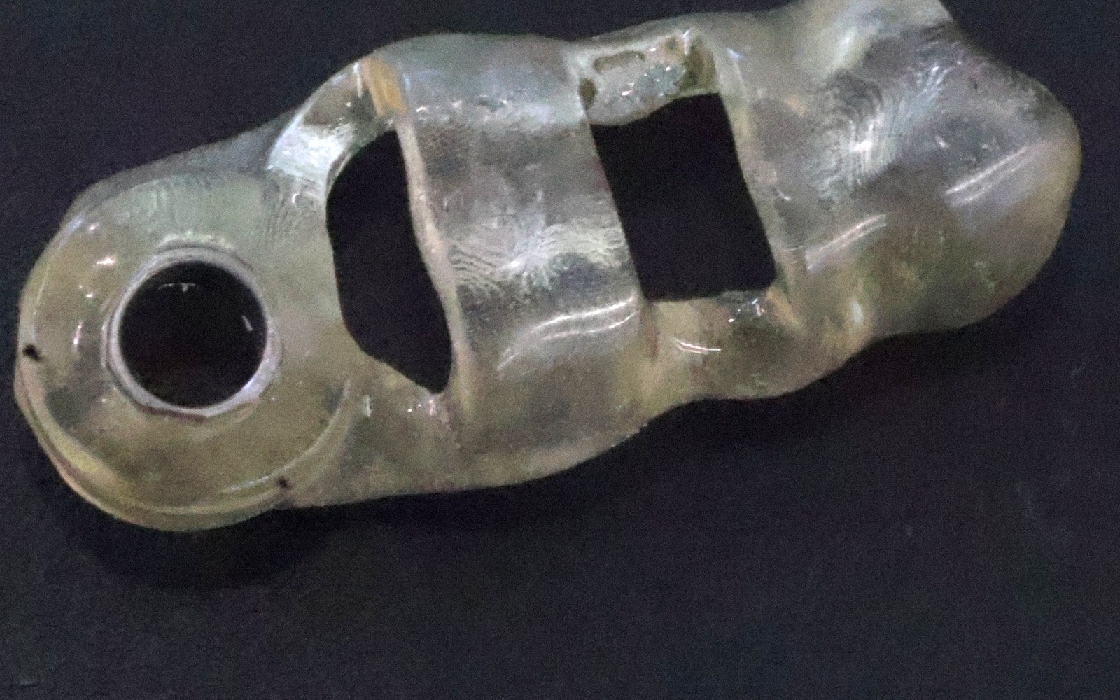 Clear 3D-printed surgical guide with a metal guide sleeve.
