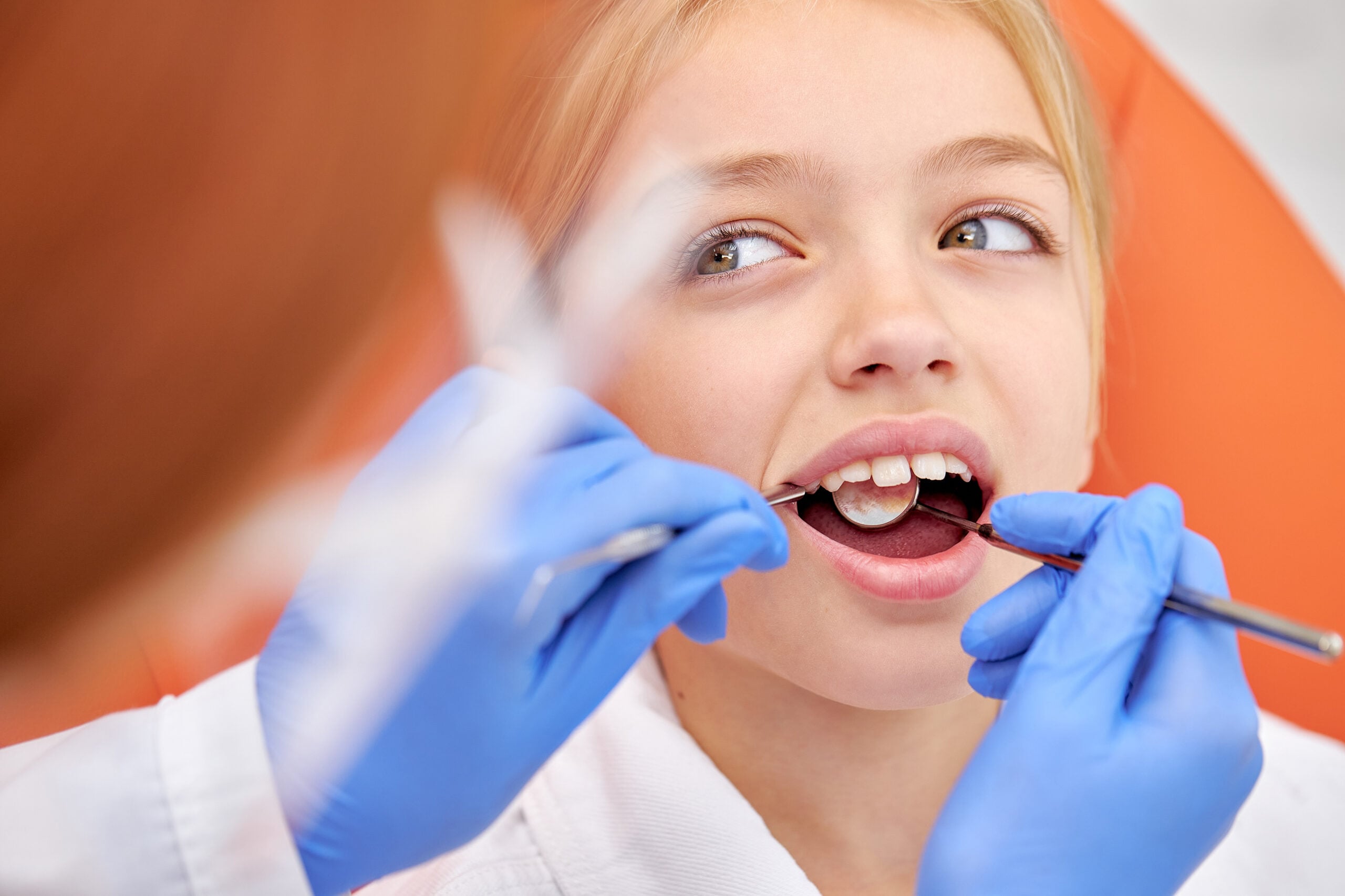 early orthodontic intervention in Vancouver, WA