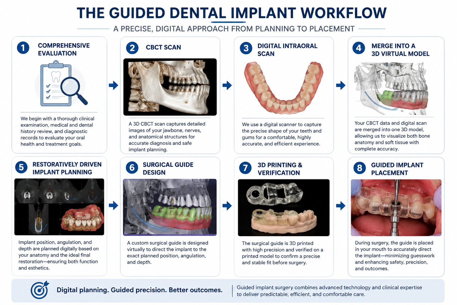 Eight-step infographic of the guided dental implant workflow: comprehensive evaluation, CBCT scan, digital intraoral scan, merging into a 3D virtual model, restoratively driven implant planning, surgical guide design, 3D printing and verification, and guided implant placement.
